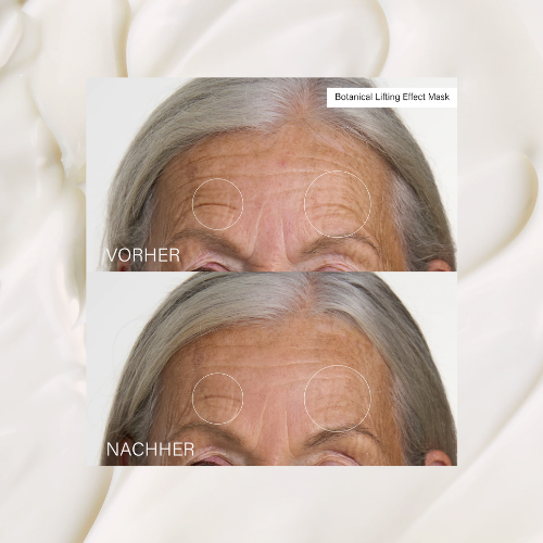 Rosental Botanical Lifting Maske: Vorher Nachher